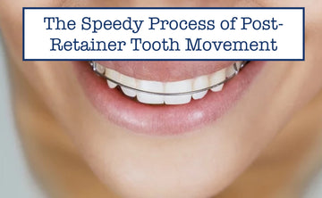 The Speedy Process of Post-Retainer Tooth Movement