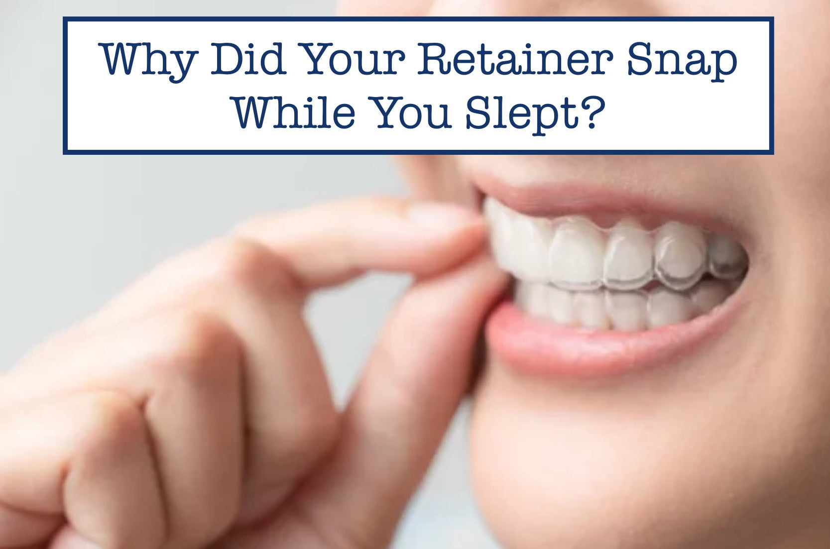Why Did Your Retainer Snap While You Slept? – B.WEISS Health