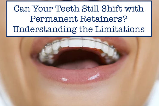  Teeth Shift with Permanent Retainers
