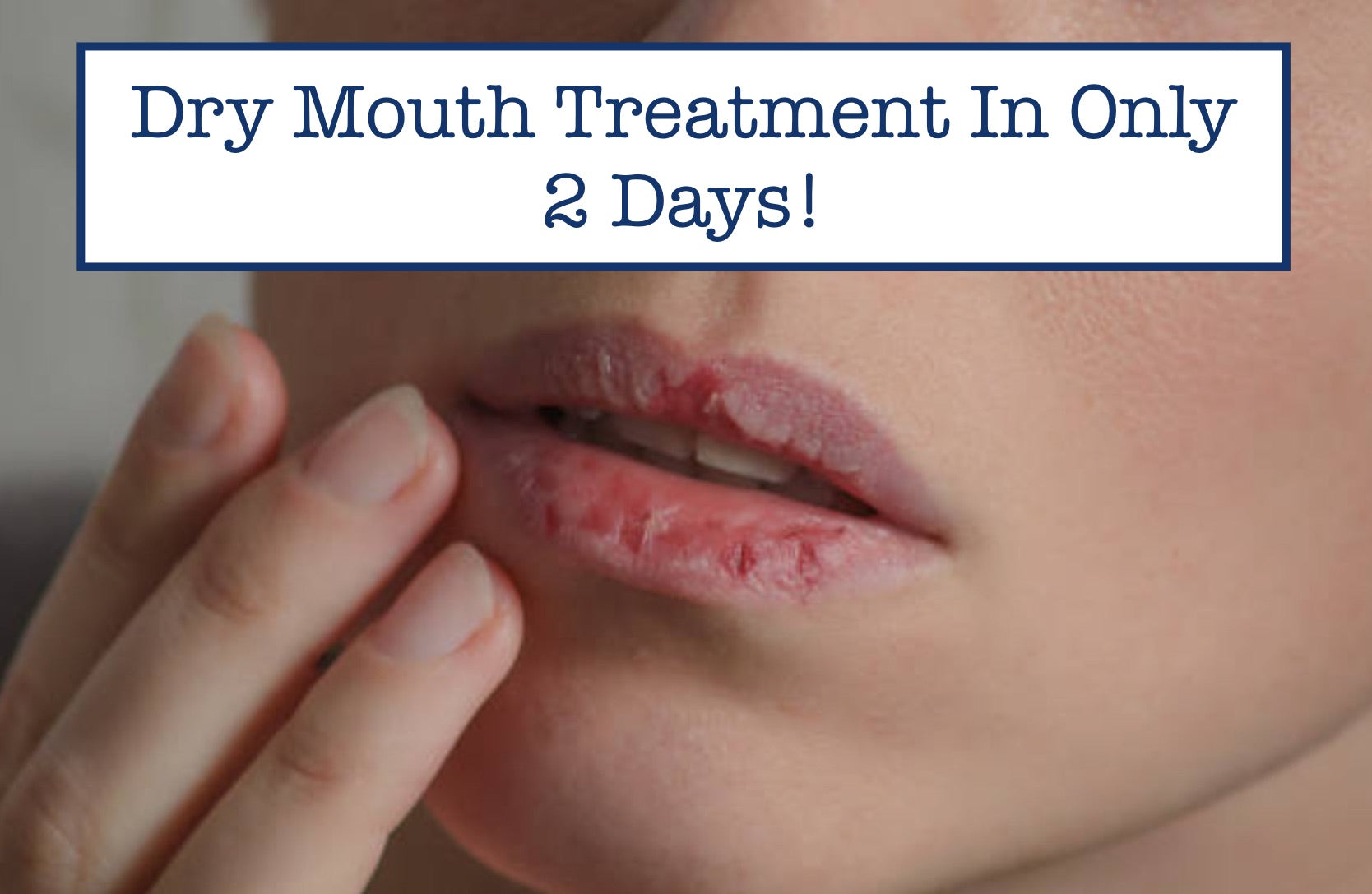 Dry Mouth Treatment In Only 2 Days!