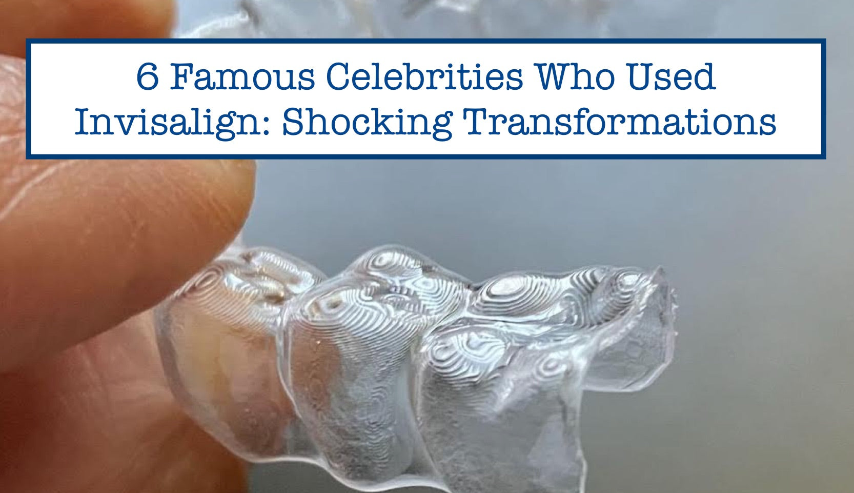 6 Famous Celebrities Who Used Invisalign: Shocking Transformations – B ...