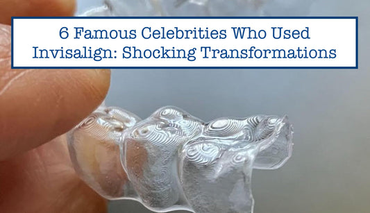 invisalign celebrity