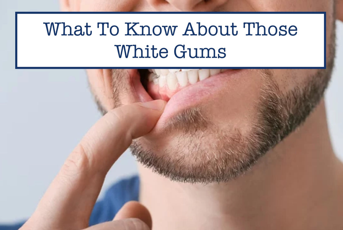 What To Know About Those White Gums: A Comprehensive Guide