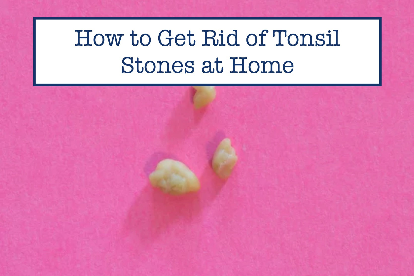 how-to-get-rid-of-tonsil-stones-at-home