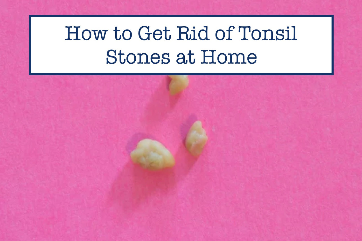 How to Get Rid of Tonsil Stones at Home – B.WEISS Health