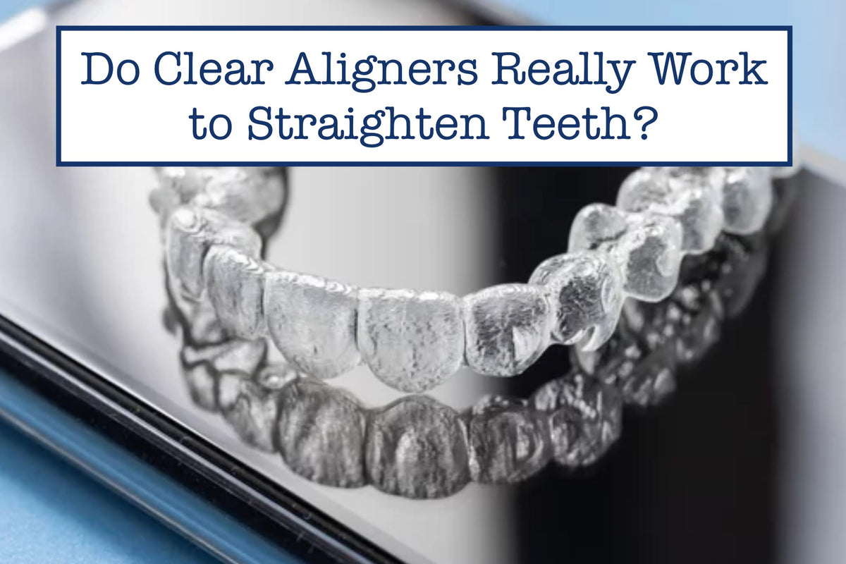 Do Clear Aligners Really Work to Straighten Teeth? – B.WEISS Health
