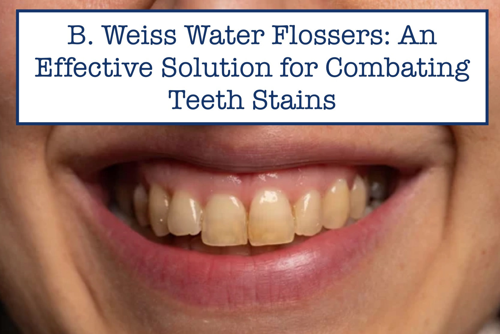 B. Weiss Water Flossers: An Effective Solution for Combating Teeth Stains