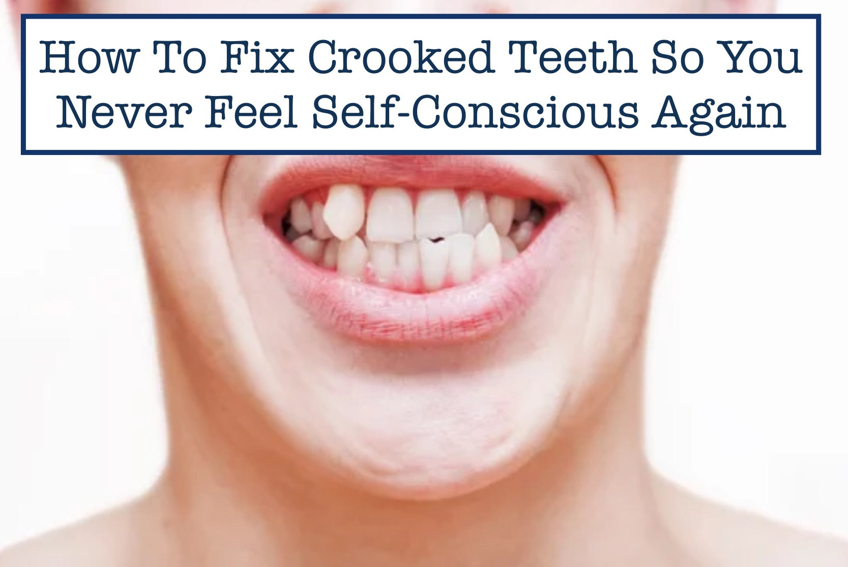 How To Fix Crooked Teeth So You Never Feel Self-Conscious Again