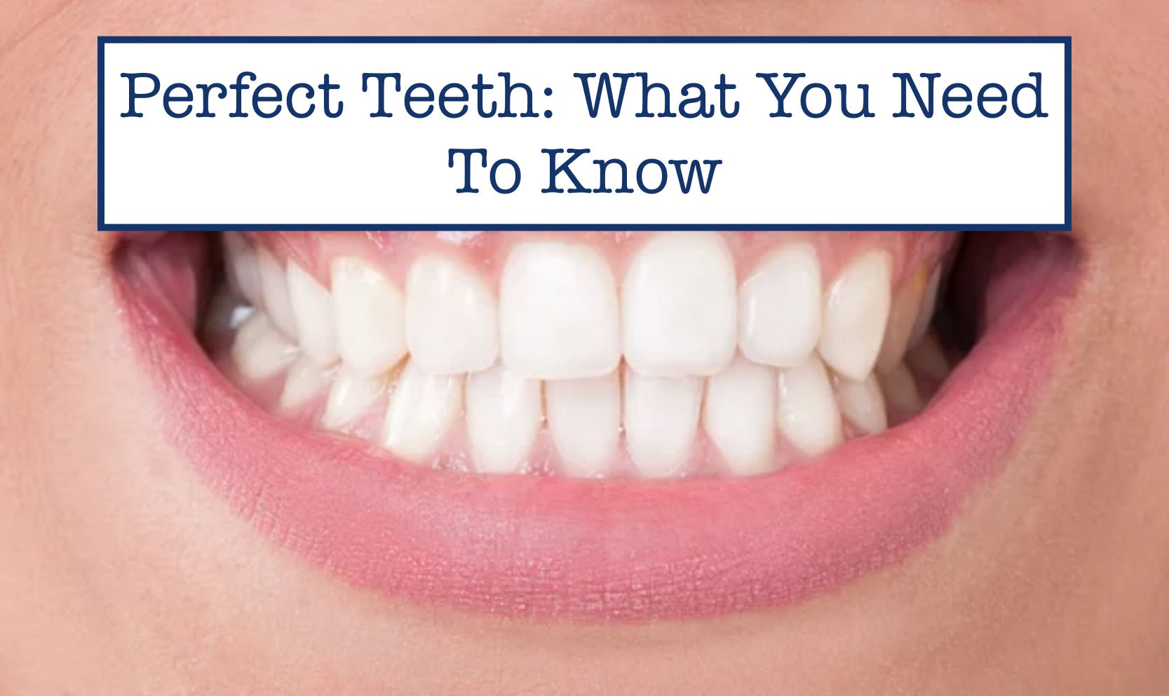 Perfect Teeth: What You Need To Know