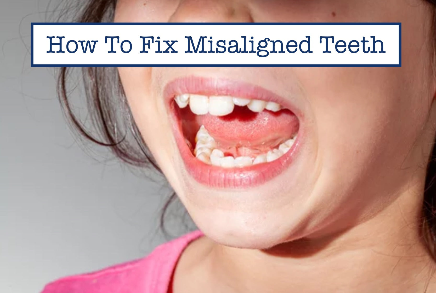 How To Fix Misaligned Teeth – B.WEISS Health