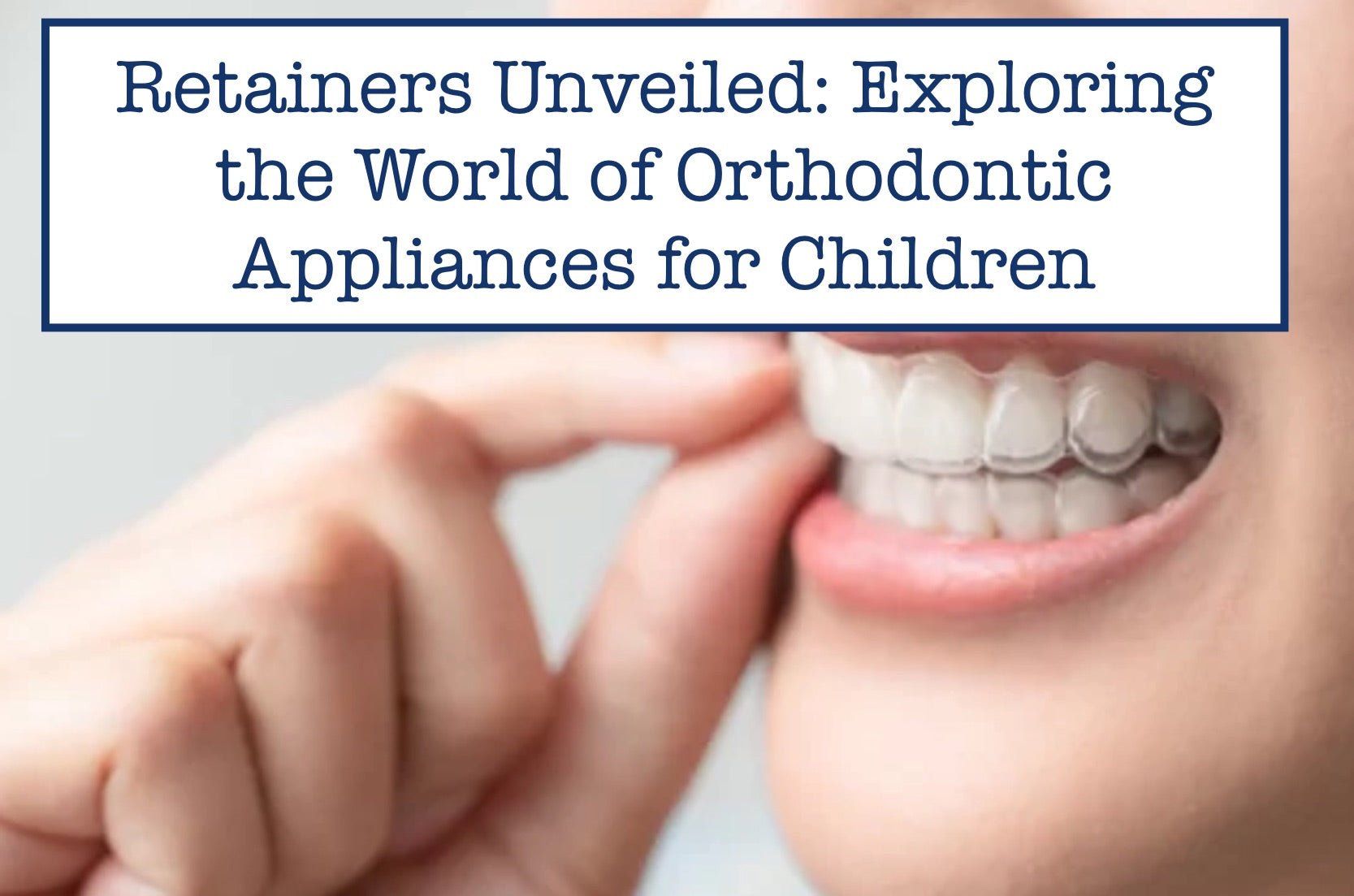 Retainers Unveiled: Exploring the World of Orthodontic Appliances for Children