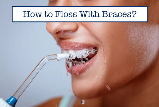 How to Floss With Braces?