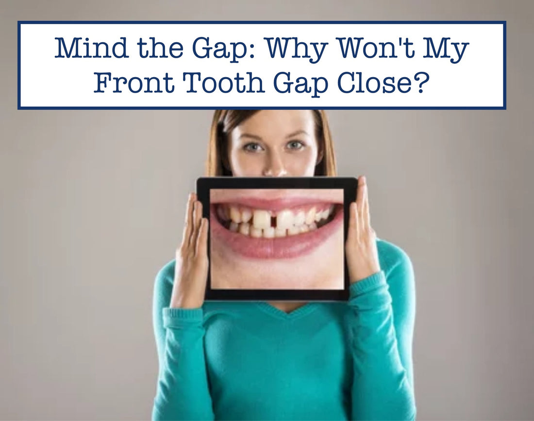 Mind the Gap: Why Won't My Front Tooth Gap Close?