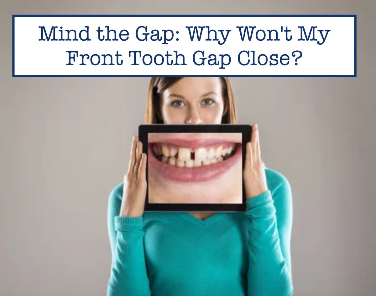 Mind the Gap: Why Won't My Front Tooth Gap Close? – B.WEISS Health