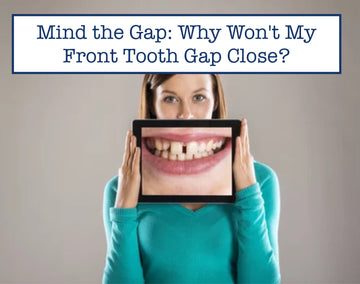 Mind the Gap: Why Won't My Front Tooth Gap Close?