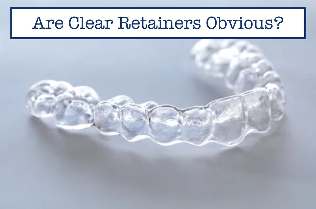 Are Clear Retainers Obvious?