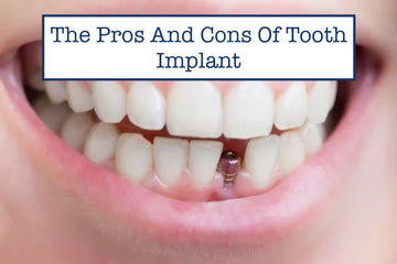 The Pros And Cons Of Tooth Implant