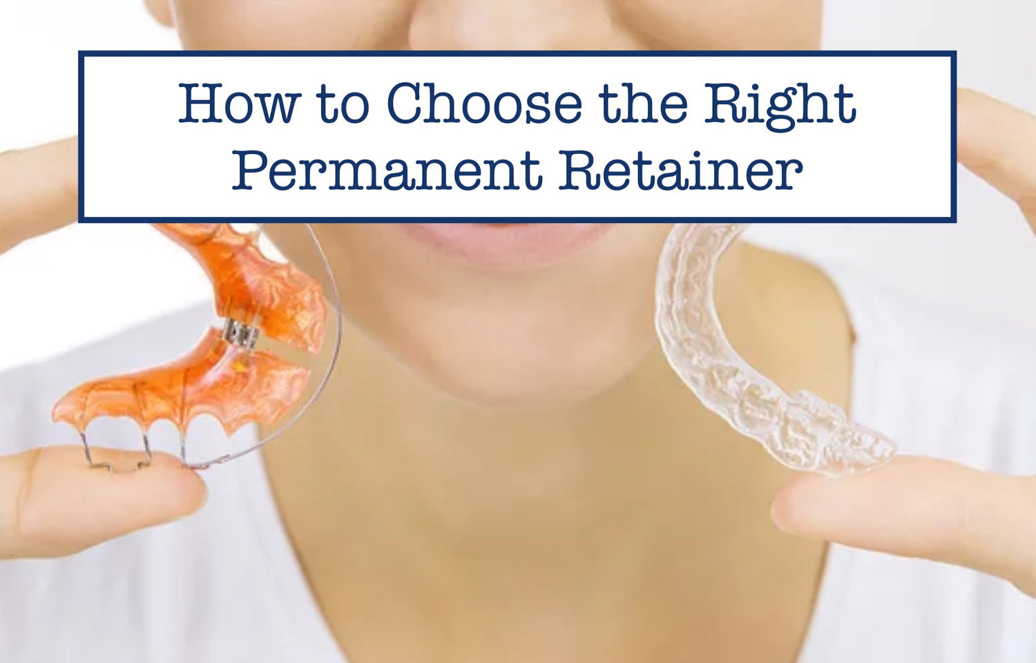 How to Choose the Right Permanent Retainer