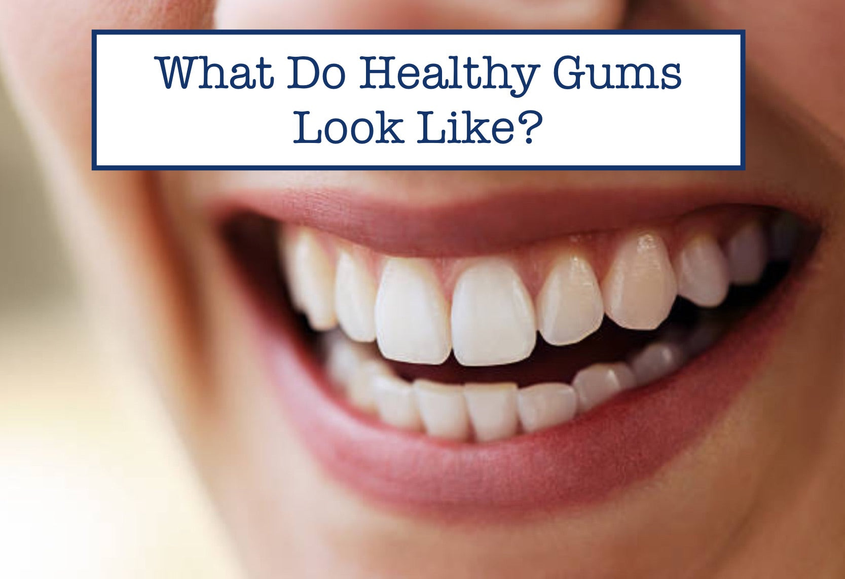 What Do Healthy Gums Look Like?