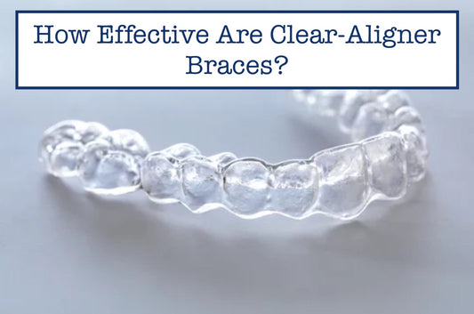 How Effective Are Clear-Aligner Braces?