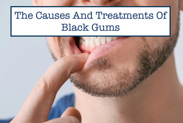 The Causes And Treatments Of Black Gums: What You Need To Know