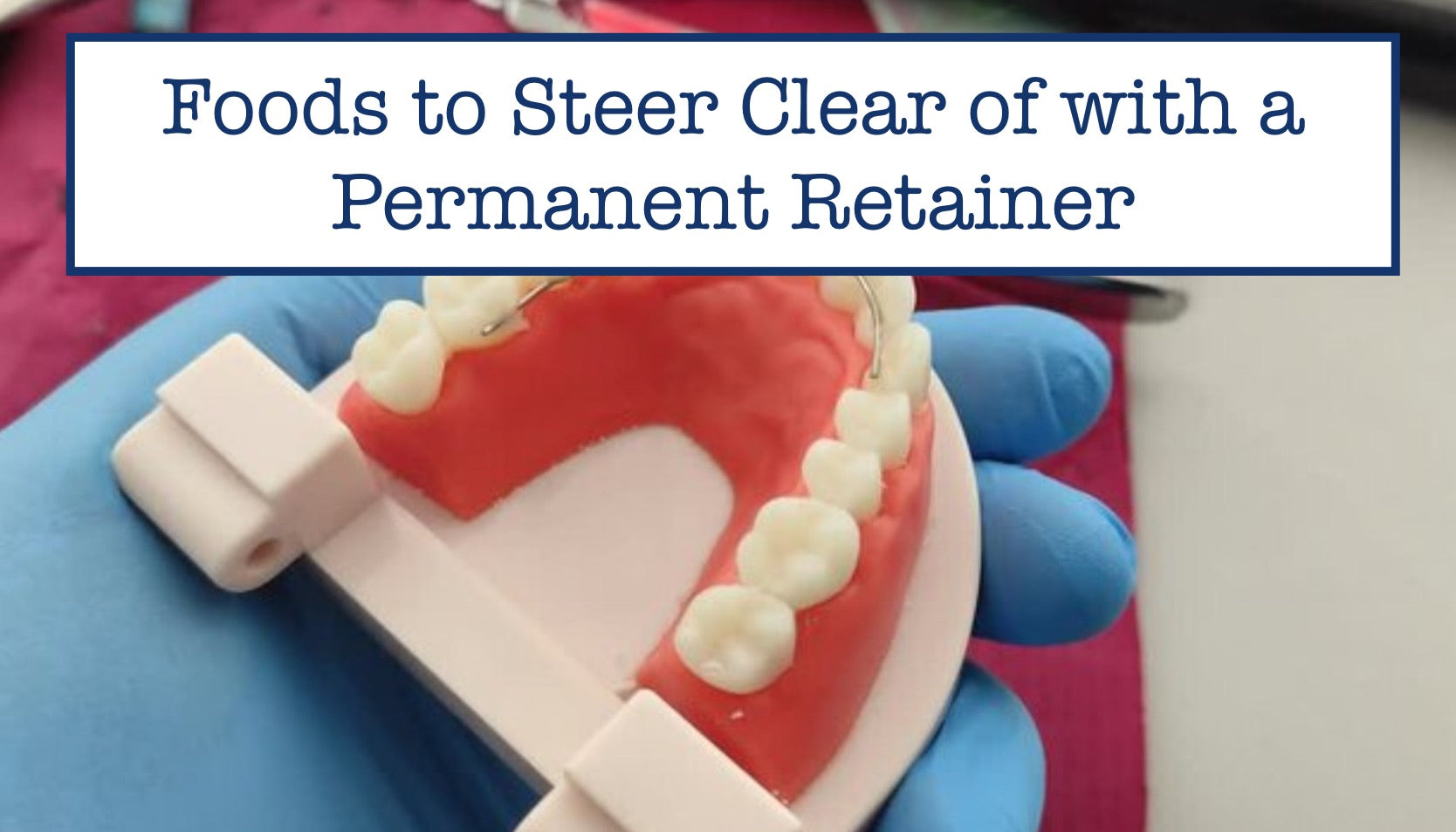 Foods to Steer Clear of with a Permanent Retainer