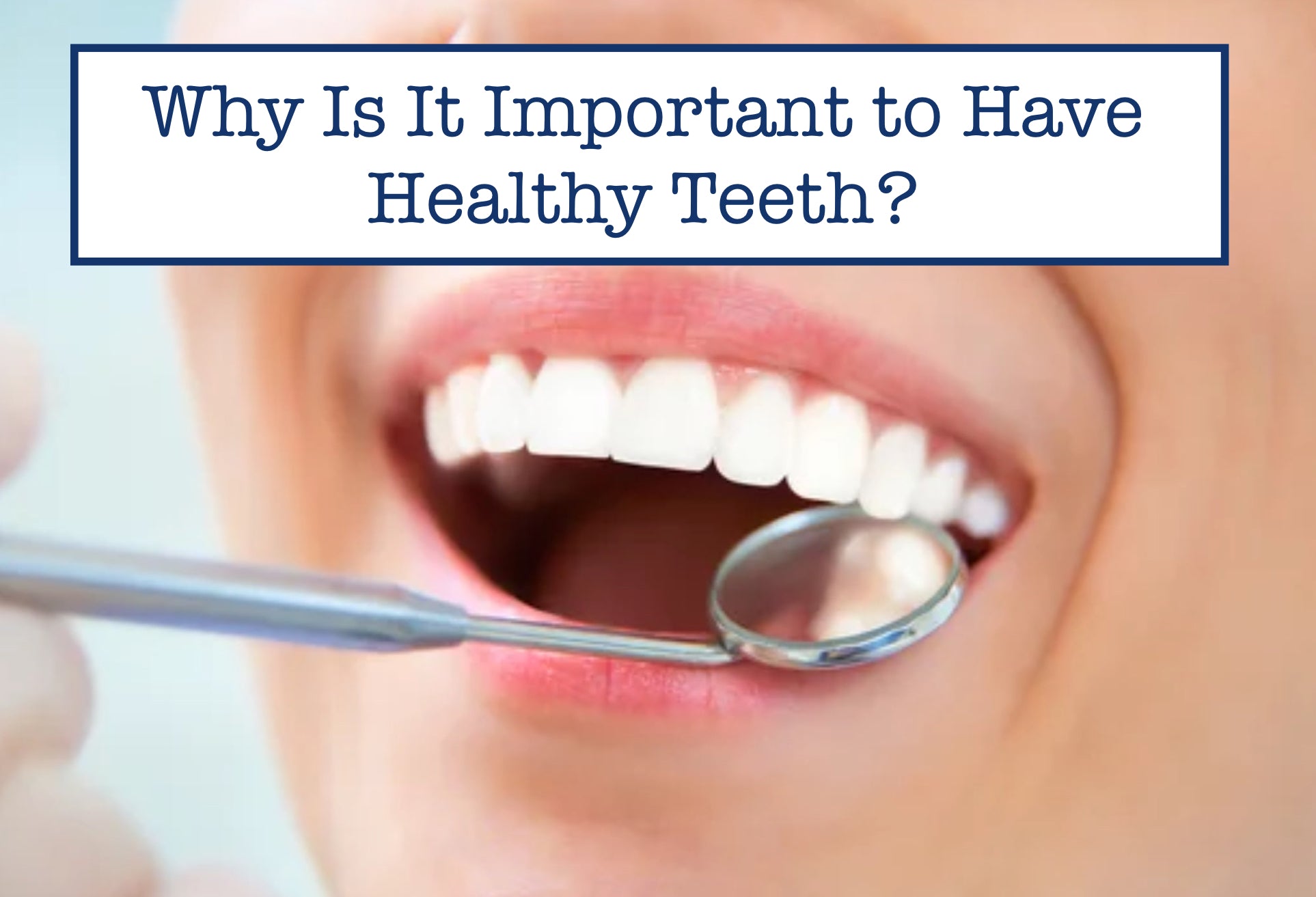 Why Is It Important to Have Healthy Teeth?