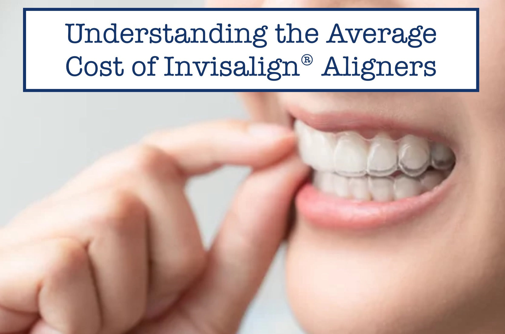 Invisalign Average Costs Too Much? Here’s What You Need to Know! B.WEISS Health