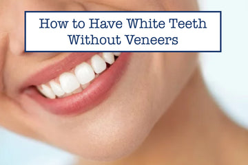 How to Have White Teeth Without Veneers