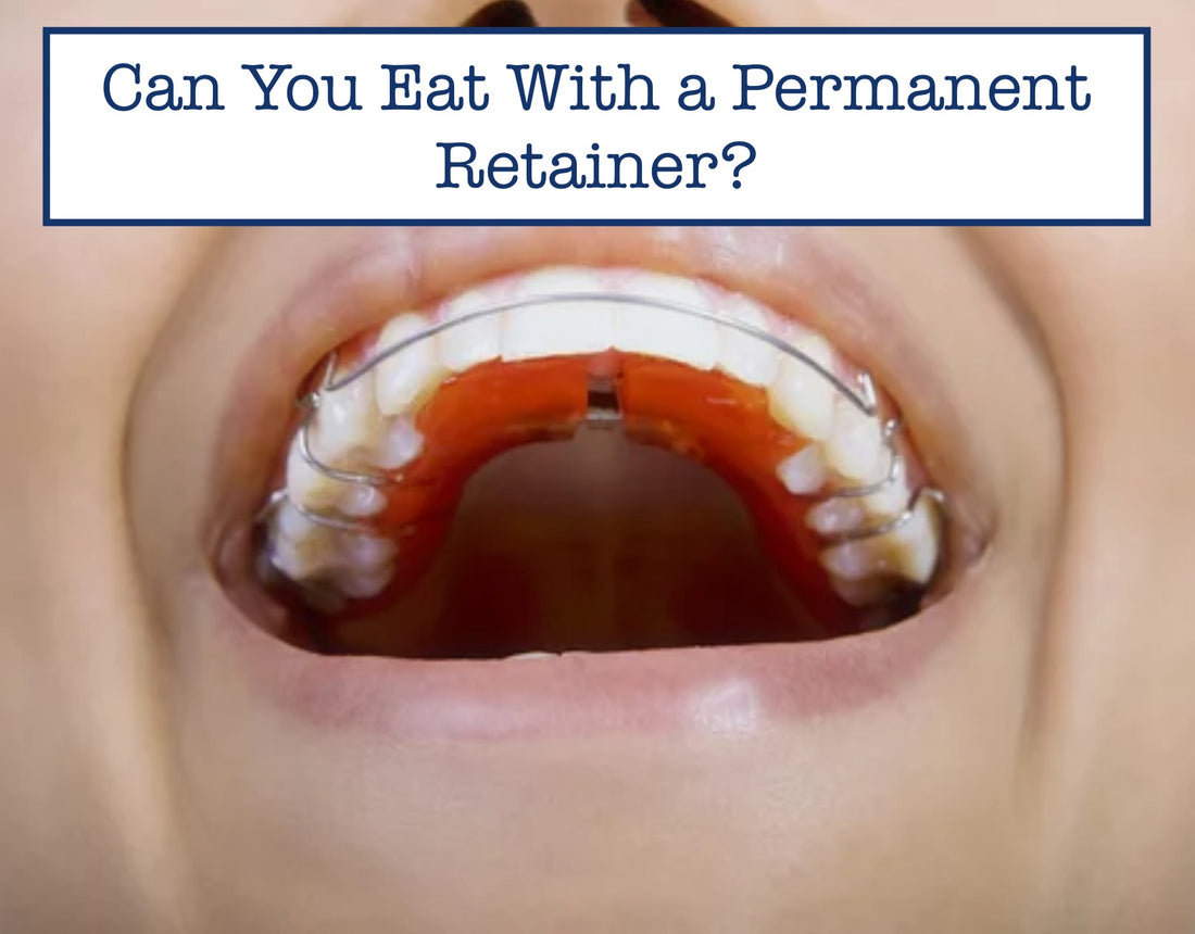 mouth with a permanent retainer