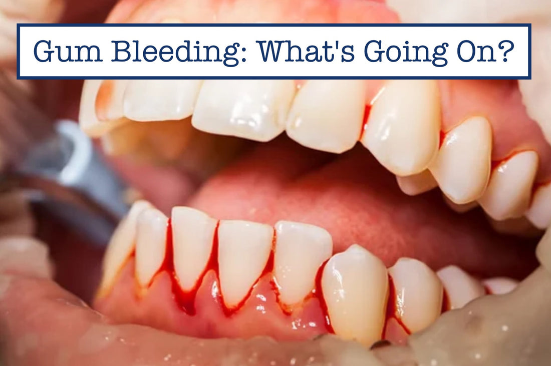 Gum Bleeding: What's Going On?