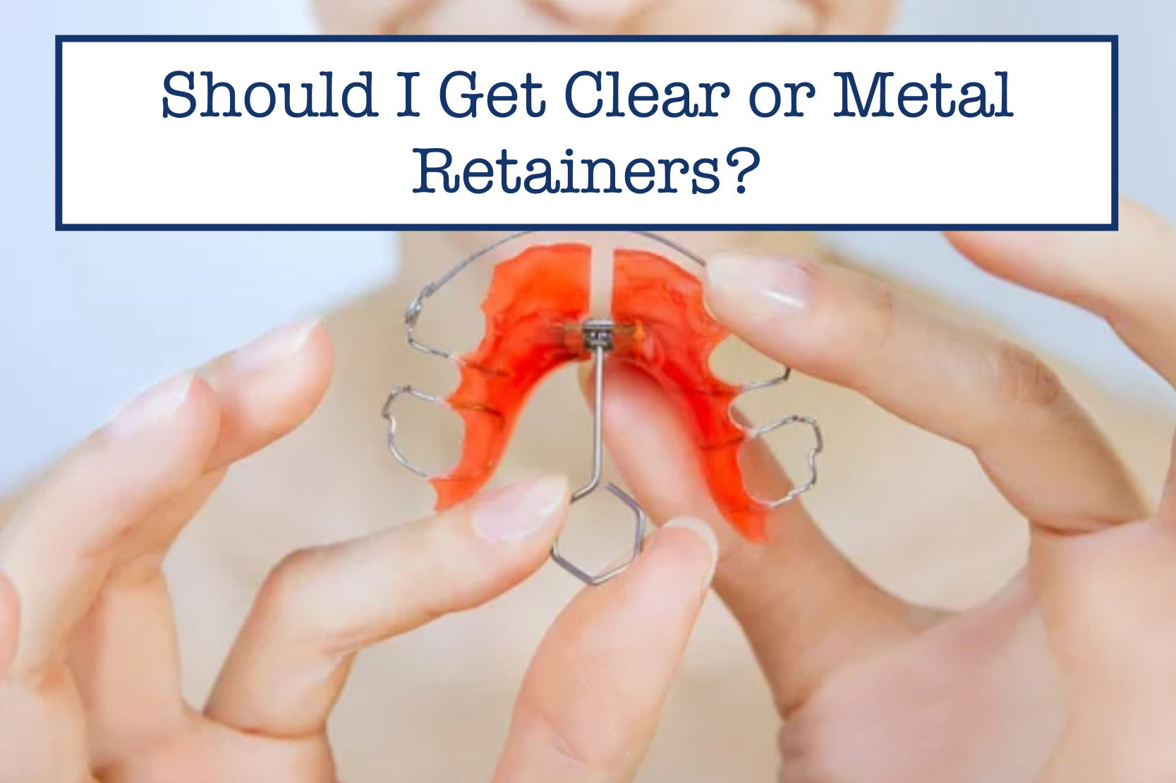 Should I Get Clear or Metal Retainers?
