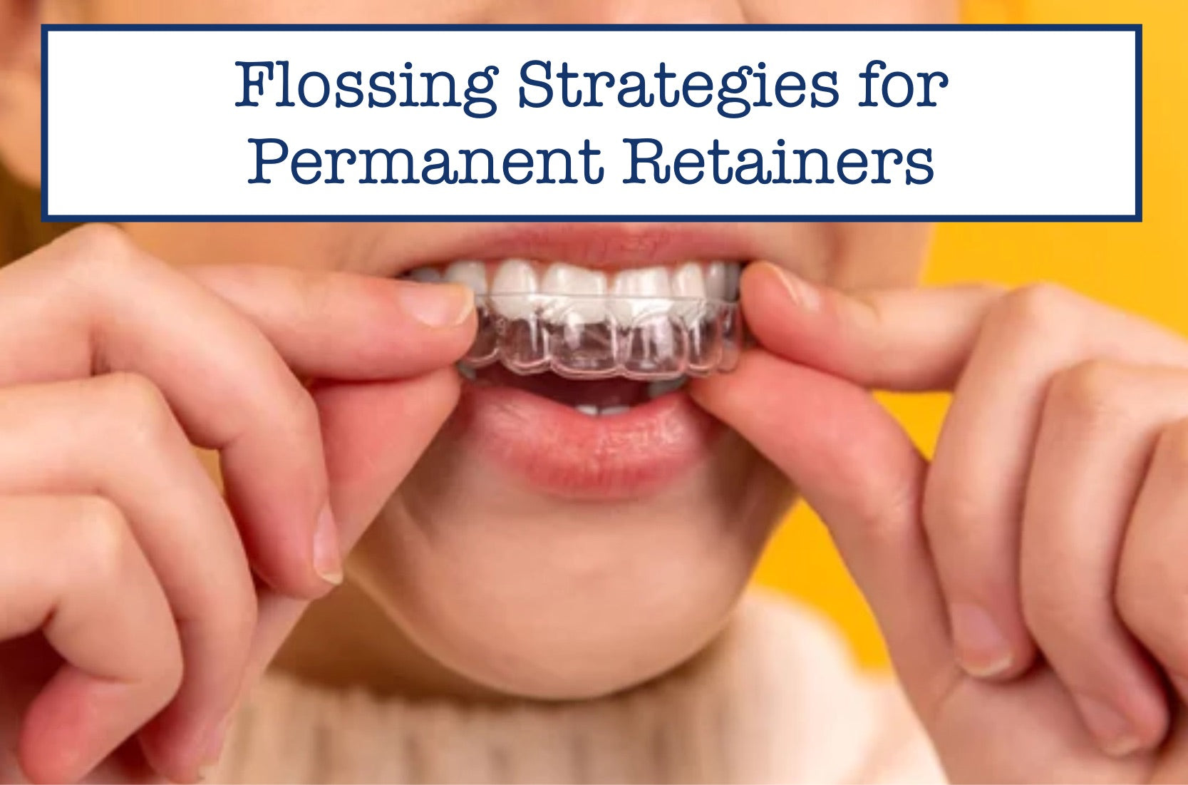 5 Effective Flossing Strategies for Permanent Retainers