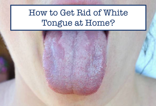 How to Get Rid of White Tongue at Home