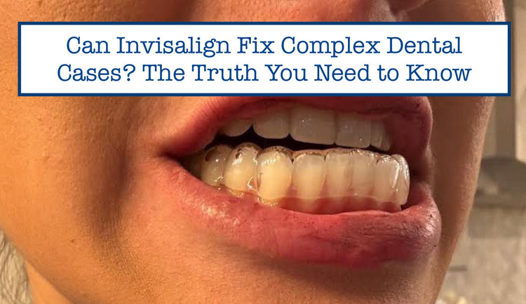 Can Invisalign Fix Complex Dental Cases? The Truth You Need to Know – B ...