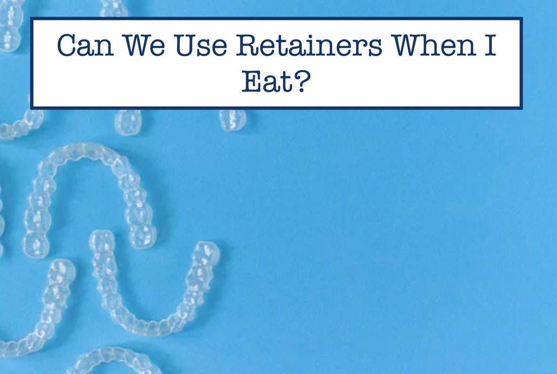 Can We Use Retainers When I Eat?