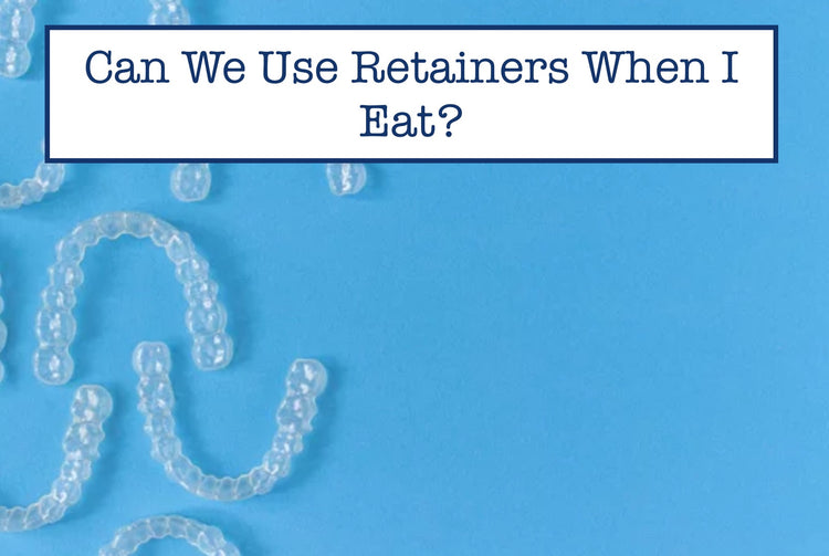 Can We Use Retainers When I Eat? – B.WEISS Health
