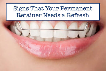 Signs That Your Permanent Retainer Needs a Refresh