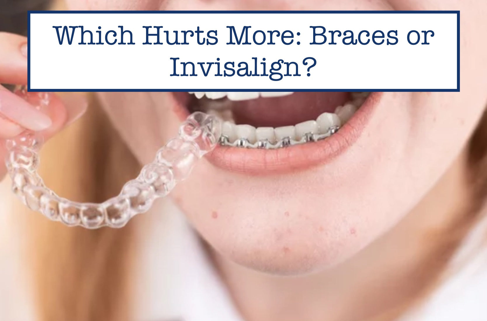 Which Hurts More Braces or Invisalign?