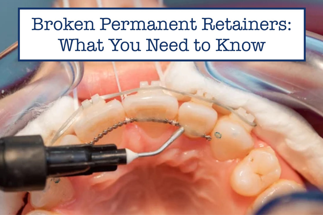 Broken Permanent Retainer