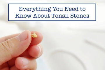 Everything You Need to Know About Tonsil Stones