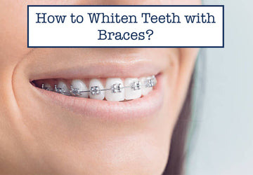 How to Whiten Teeth with Braces