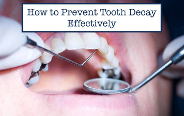 How to Prevent Tooth Decay Effectively