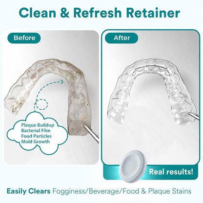 Daily Retainer & Aligner Cleaner Tablets mint scented