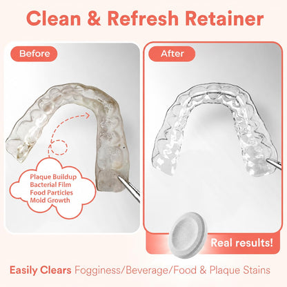 Daily Retainer & Aligner Cleaner Tablets Mint-Scented | No DYE