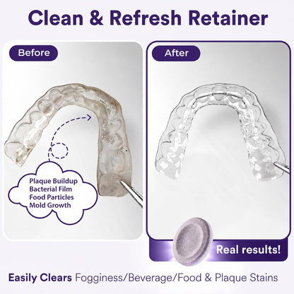 Daily Retainer & Aligner Cleaner Tablets grape scented
